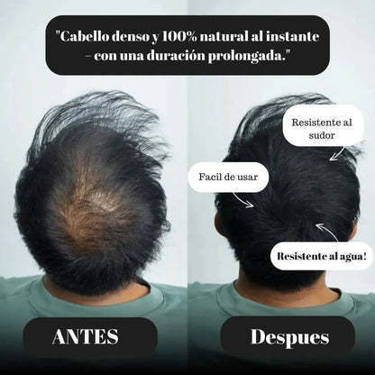 Tinte Profesional Especial Cubre Calvicie y Canas