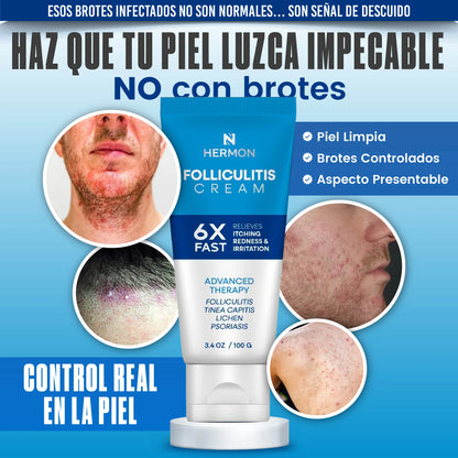 Tratamiento organico para la foliculitis del rostro y cuerpo