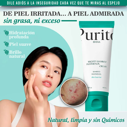 Crema vegana con tratamiento antiacné e imperfecciones